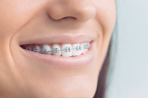 Best Invisalign and Clear Aligners  in Dodson Branch, TN